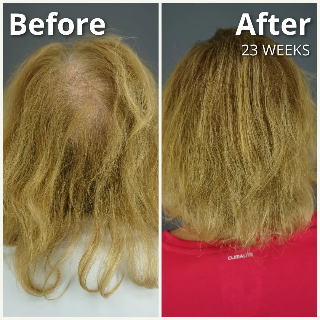 Gashee Botanical Hair Supplement - Samson