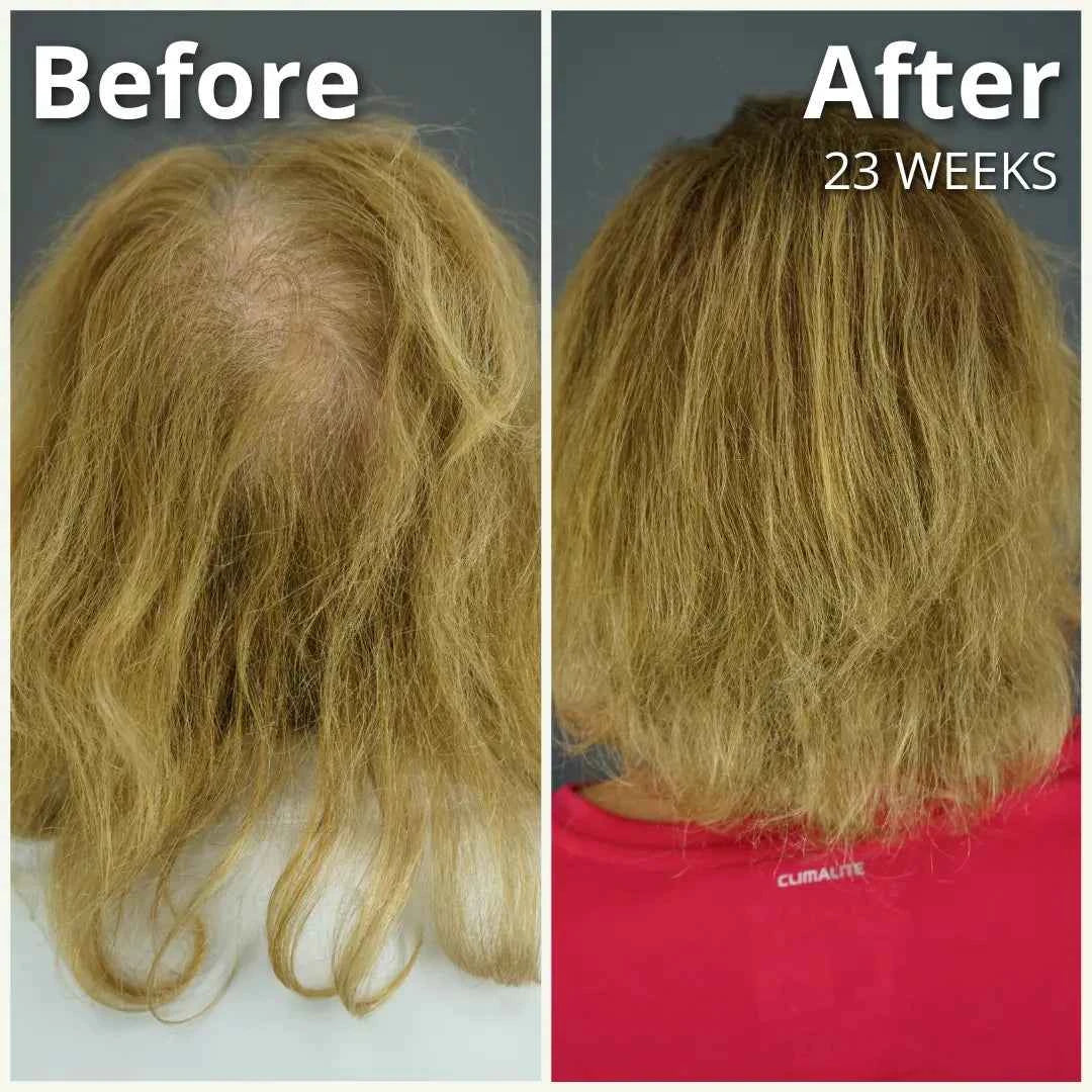Gashee Botanical Hair Supplement | Samson