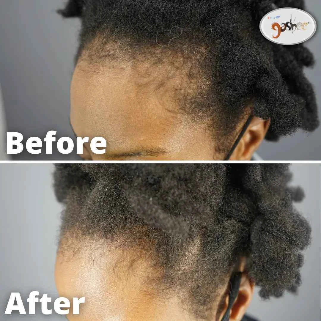 Gashee Botanical Hair Supplement | Samson