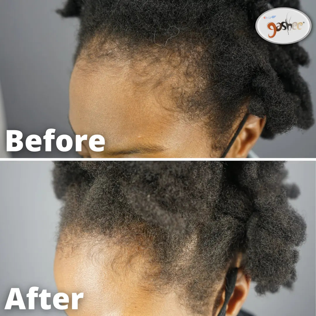 GASHEE Hair Stories: Amazing 4-Month Natural Hair Growth Results